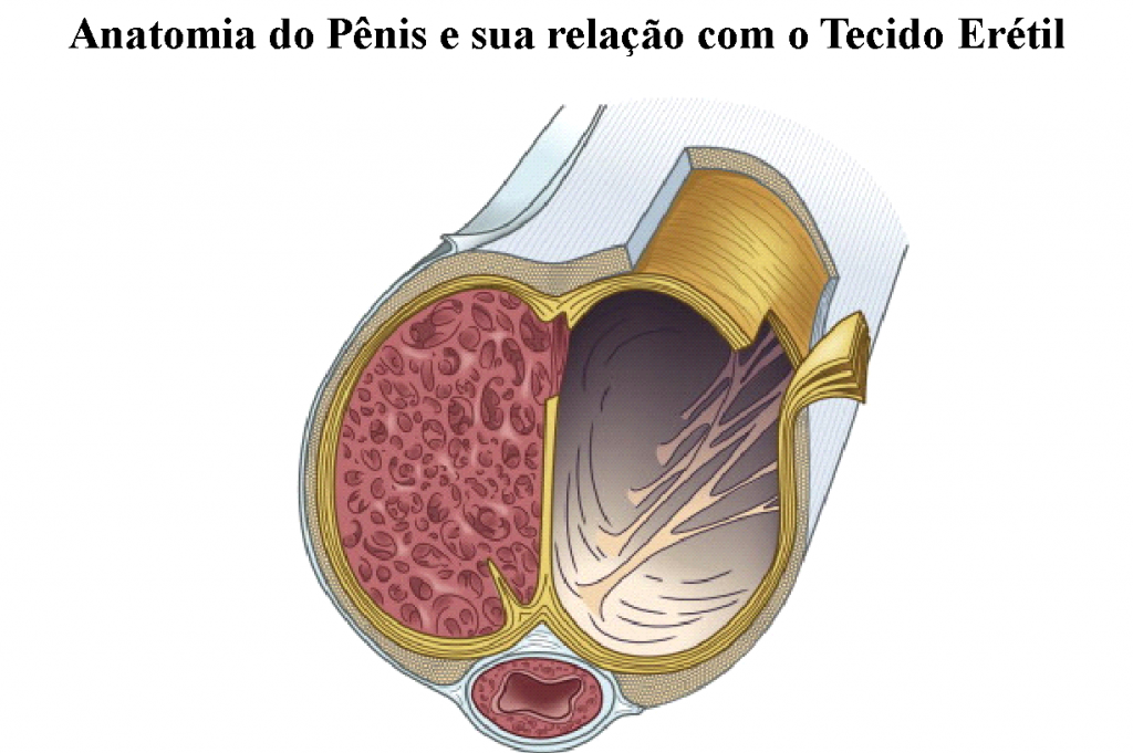 Doença de Peyronie ou Curvatura Peniana Dr Paulo Rodrigues