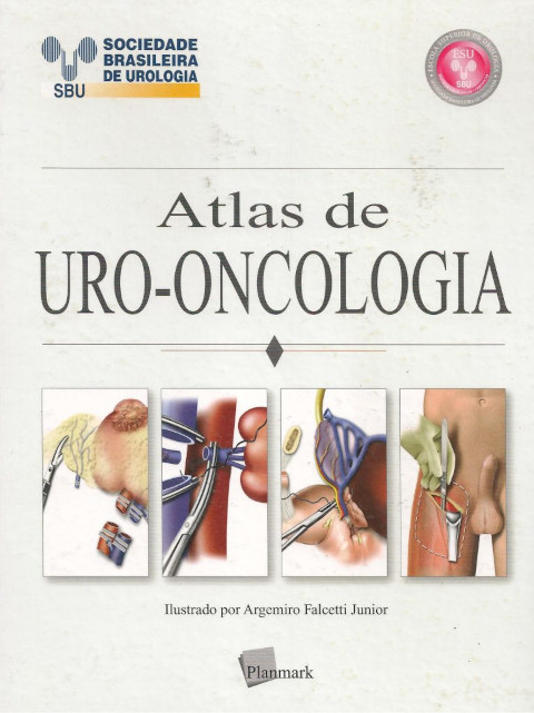 Atlas de Uro-oncologia